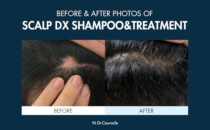 Dr. Ceuracle Scalp DX Scaling Shampoo 500ml — view 3