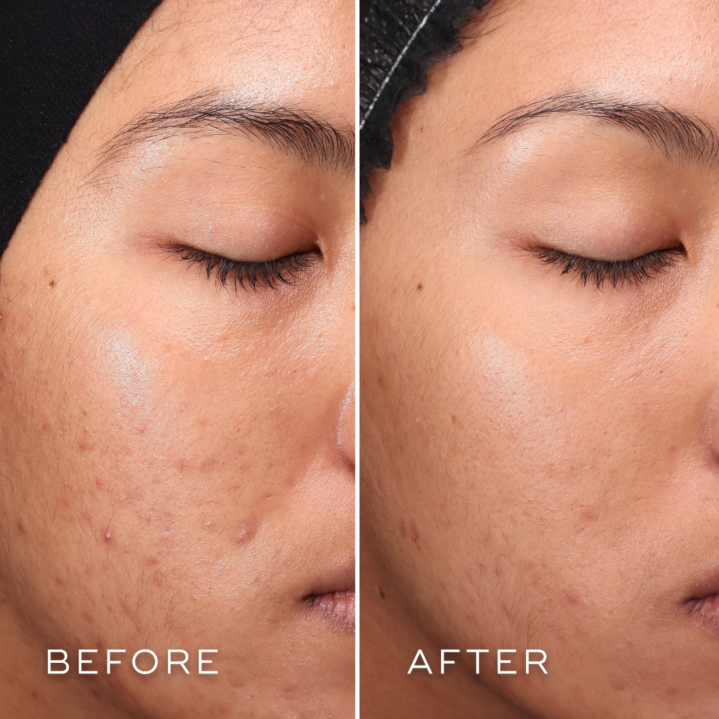 Medik8 Press & Clear Refill 150ml  — view 2