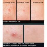 Pyunkang Yul Acne Spot Cream 15ml — view 2