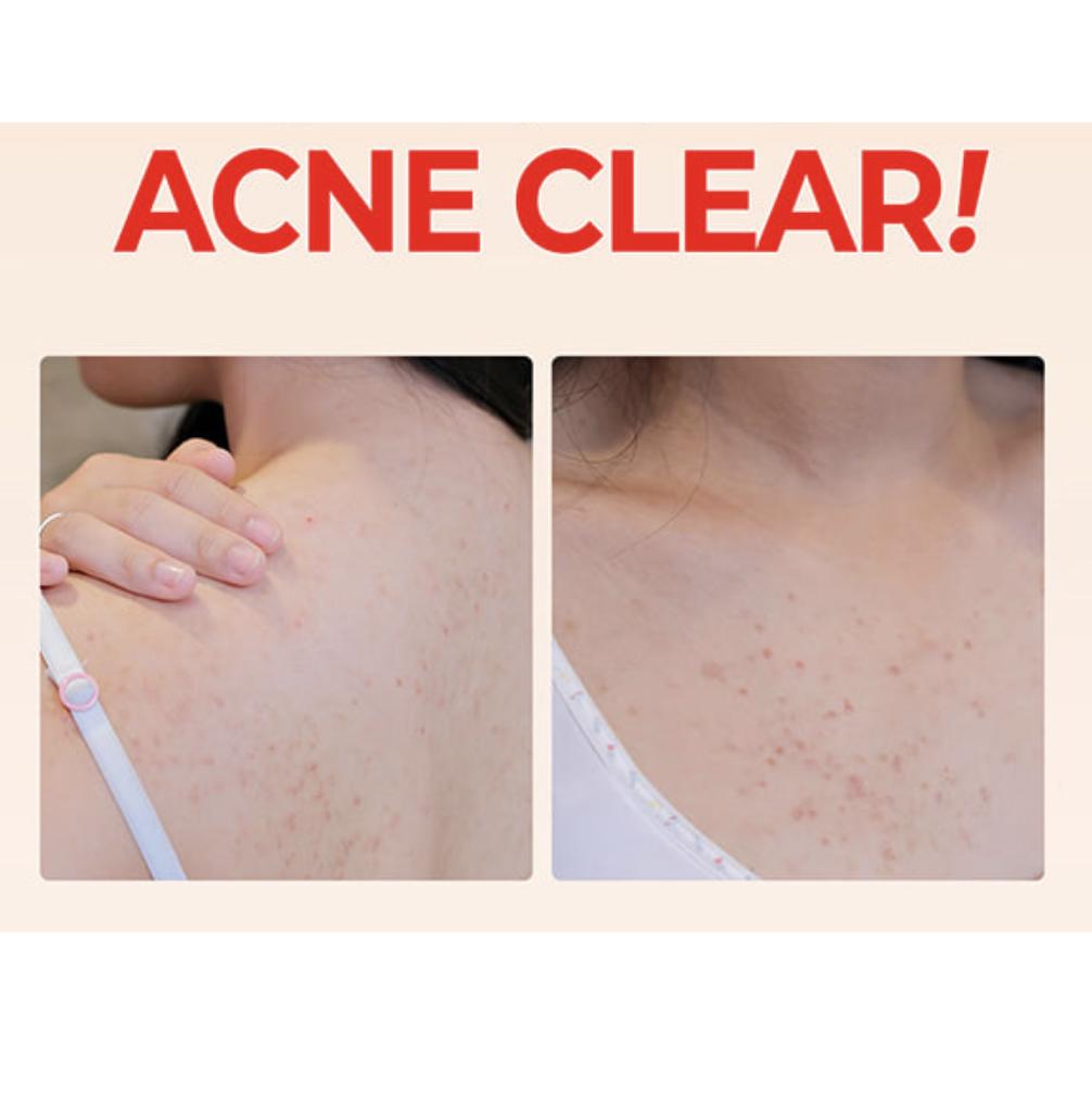 Some By MI Aha Bha Pha 30 Days Miracle Acne Clear Body Cleanser 400g — view 2