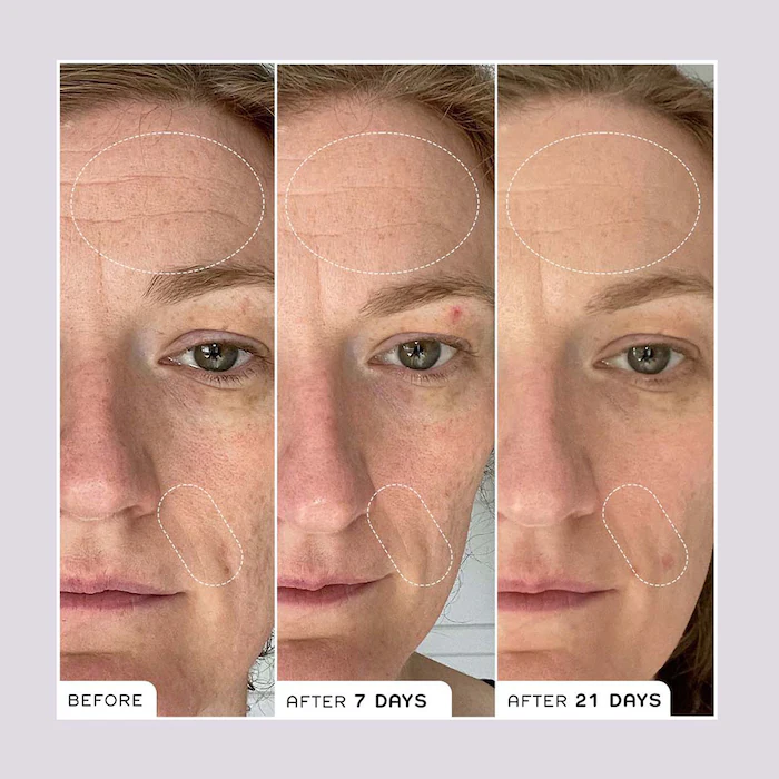 Ren Bio Retinoid Youth Serum 30ml  — view 2