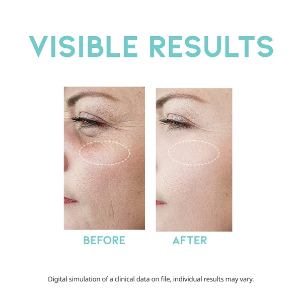 OOTD Wrinkle Lift Retinol Serum 50ml — view 2