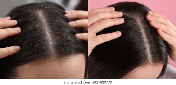 K89 Anti Dandruff Shampoo 330ml — view 2