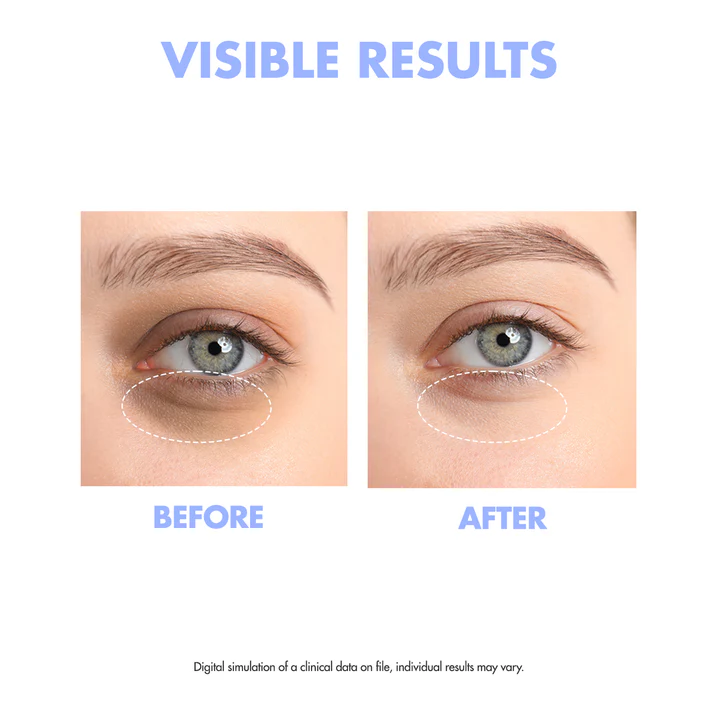 Ootd Intensive Eye Serum H+  30g  — view 2