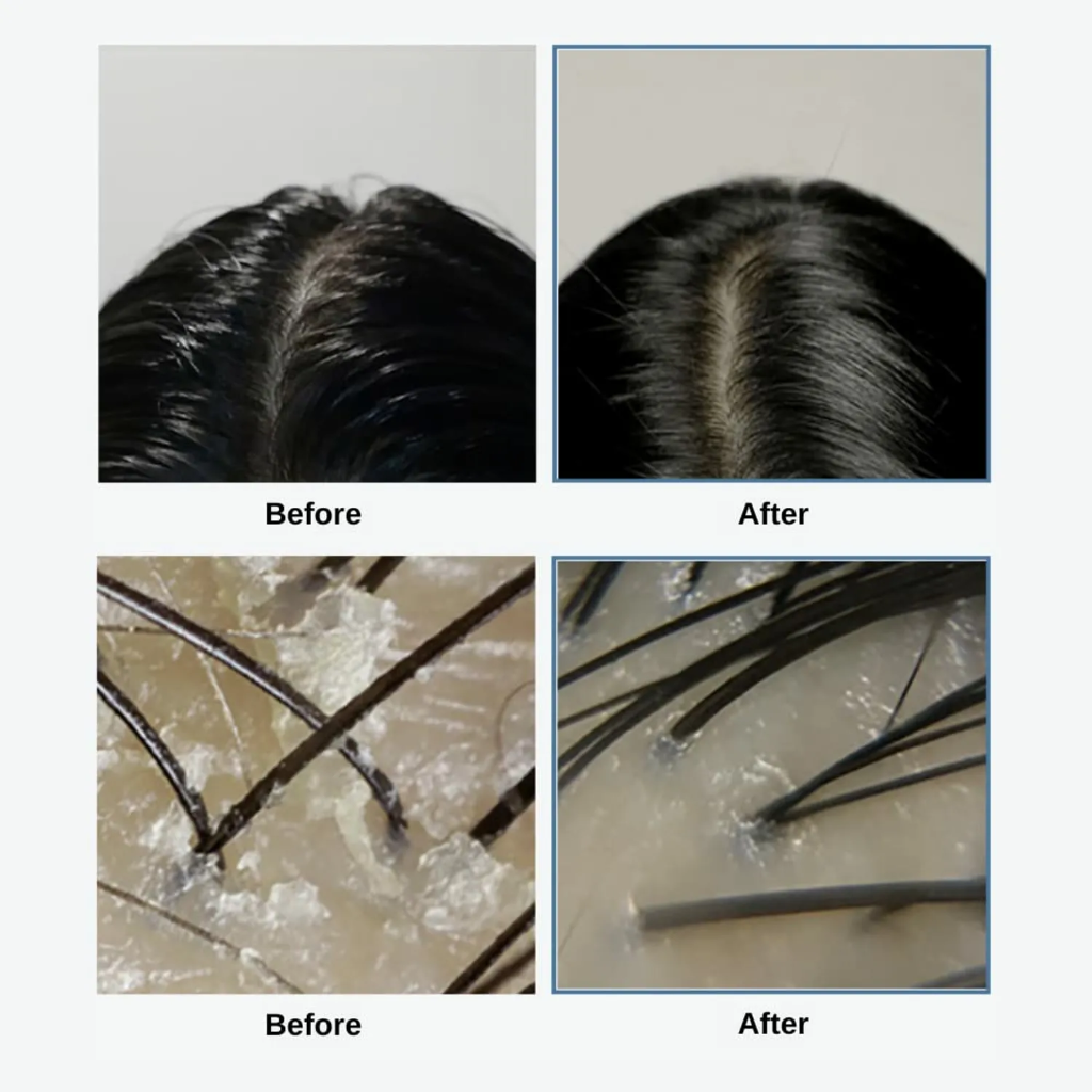 Grows Sea Salt Therapy Scalp Scaler 120g   — view 2