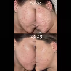 Iunik Centella Calming Ac Spot Cream 20ml — view 2