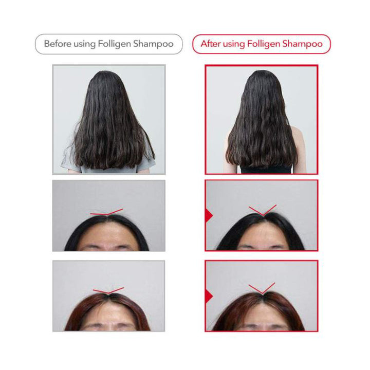 Dr.FORHAIR Folligen Original Shampoo 500ml  — view 2