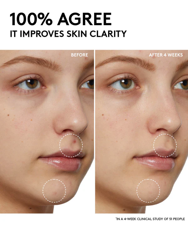 Fenty Skin Cherry Dub Pore Purifyr Gel Cleanser 190ml — view 2