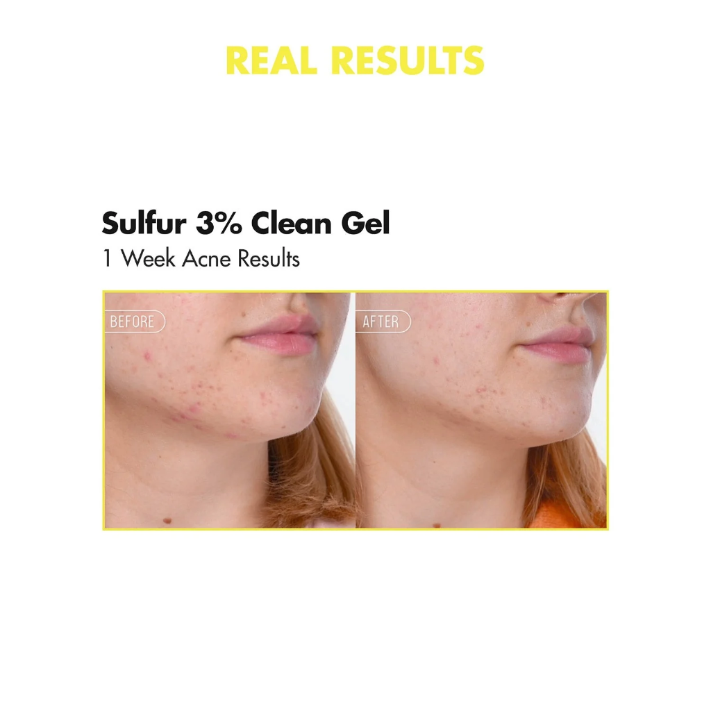 By Wishtrend Sulfur 3% Clean Gel  — view 2