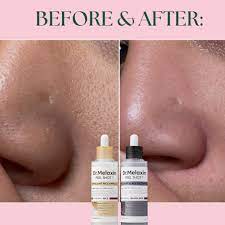 DX.Melaxin Peel Shot Exfoliating Black Rice Ampoule 80ml — view 4