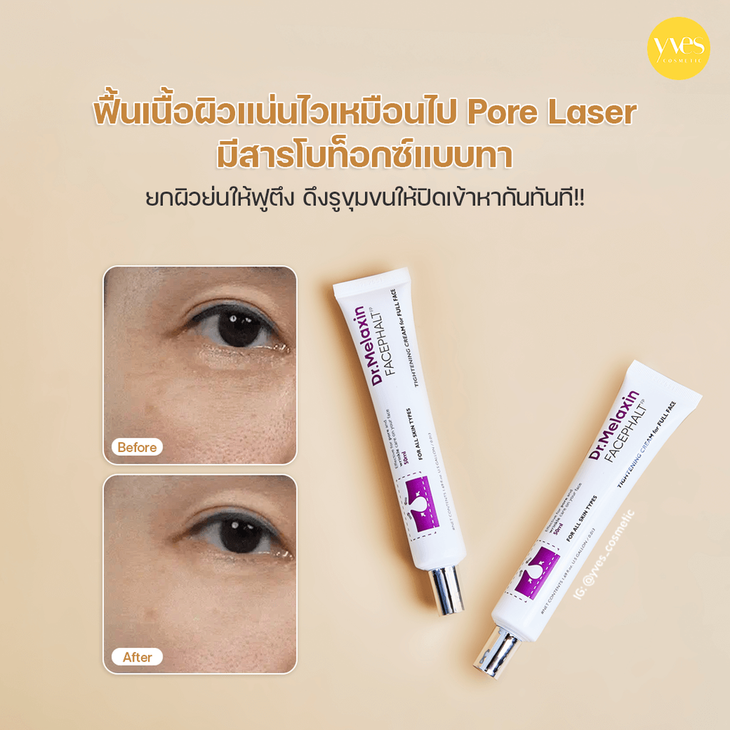 DX.Melaxin Face Phalt Tightening Cream 50g — view 2