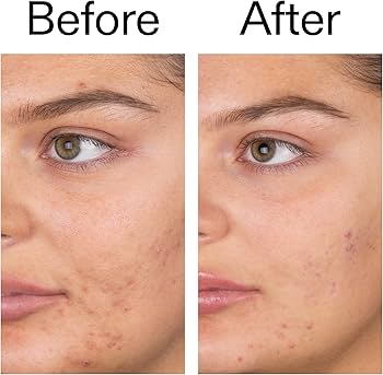 The Inkey List Fulvic Acid Cleanser 150ml  — view 2