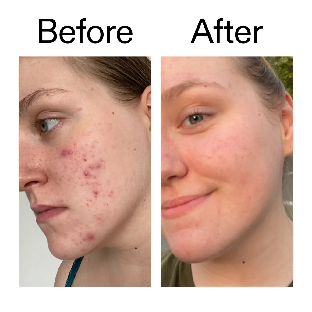 The Inkey List 15% Vitamin C And EGF Serum 30ml — view 2