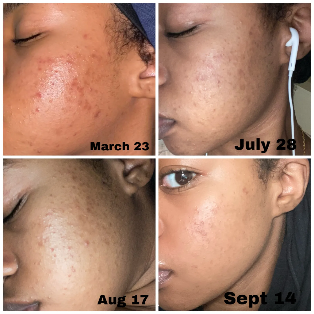 The Inkey List Tranexamic Acid Serum 30ml — view 2