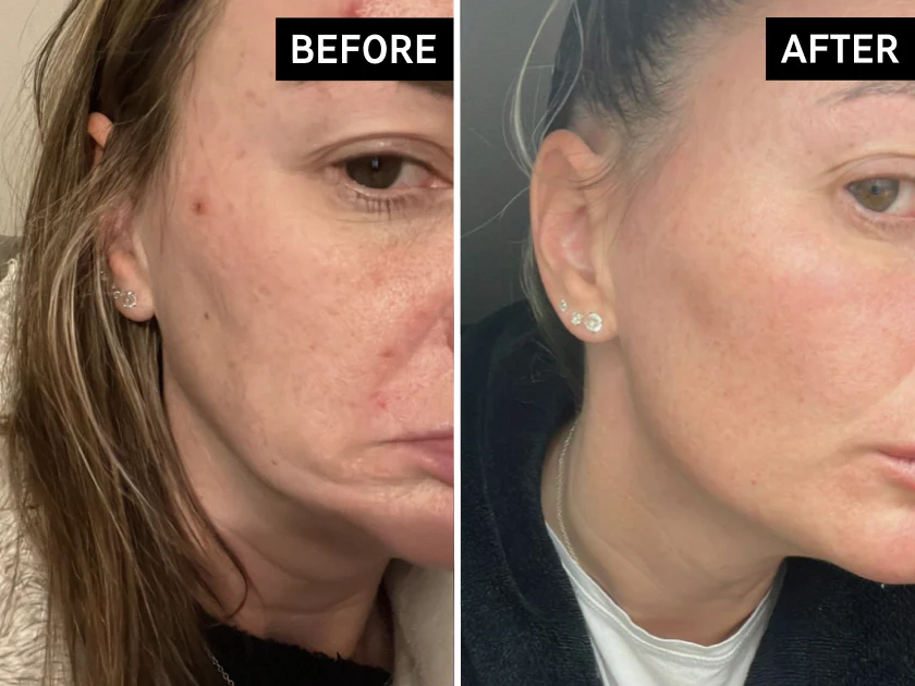 The Inkey List Collagen Peptide Serum 30ml — view 2