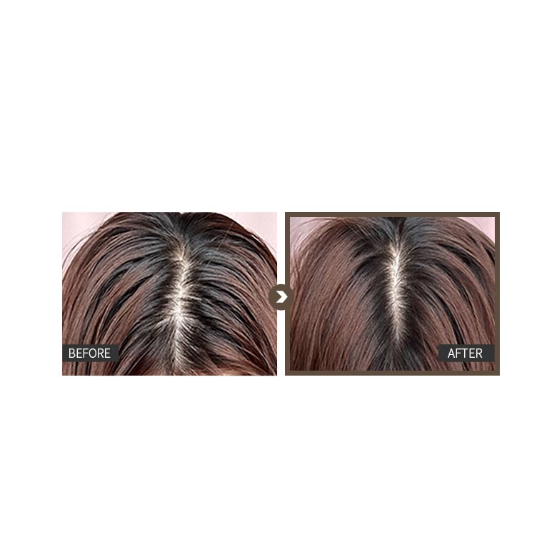 Monclos Scalp Solution Shampoo 500ml — view 2