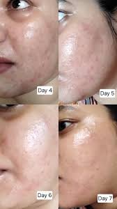 Kopher Curepair Mela Cream 35ml — view 2