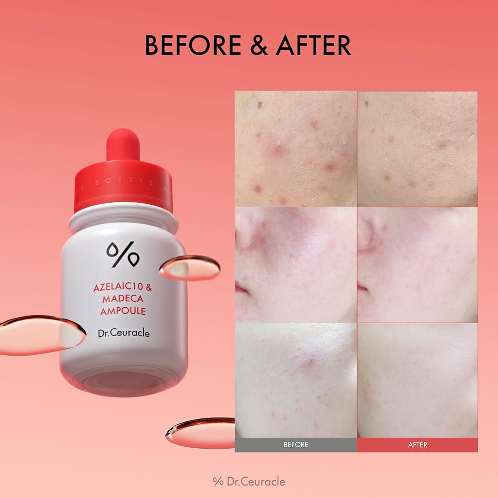 Dr.Ceuracle Azelaic 10 & Madeca Ampoule 30ml — view 3