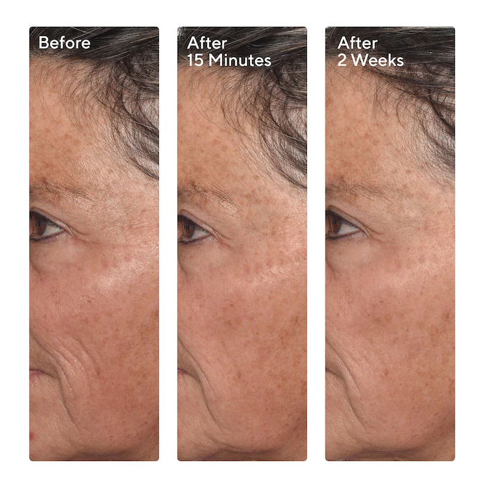 Murad Targeted Wrinkle Corrector 15 ml — view 2
