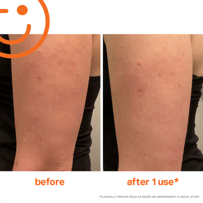 Kate Somerville Exfolikate Body Scrub 15 ml — view 2
