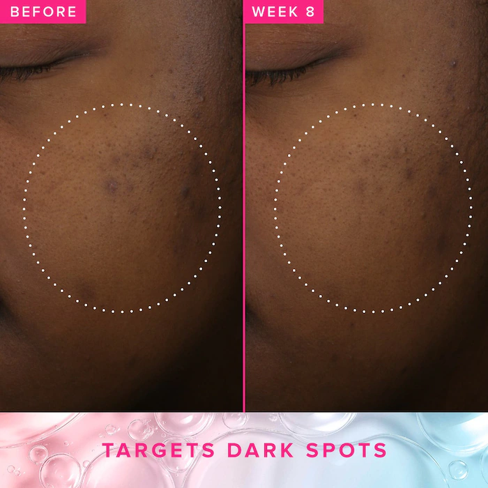 Farmacy Brighten Up 3% TXA Dark Spot Toner 120ml — view 3