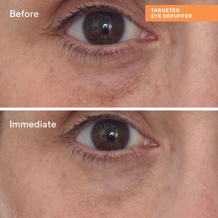 Murad Targeted Eye Depuffer 15ml — view 2