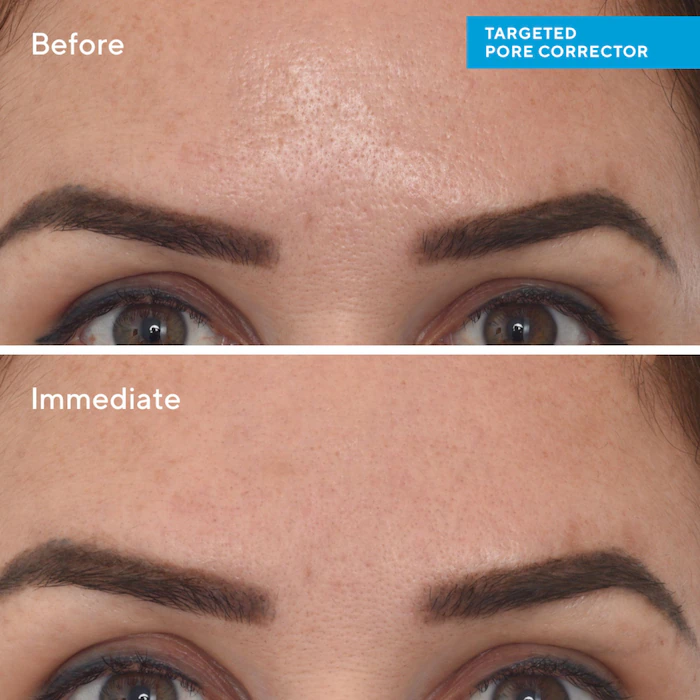 Murad Targeted Pore Corrector 15ml — view 2