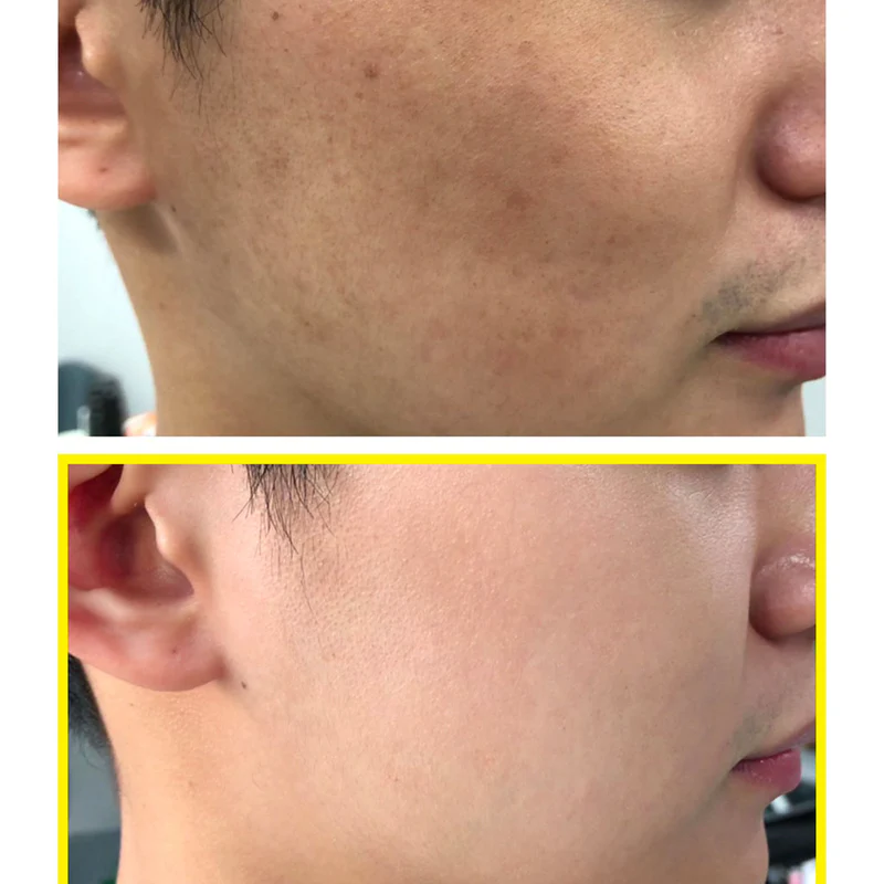 Some By Mi YUJA NIACIN 30 DAYS MIRACLE BRIGHTENING TONER 150ML — view 2